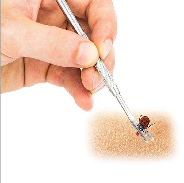 2 In 1 Stainless Steel Dog Flea Remover Tick Removal Tool Double Head Fork Tweezers Clip Dogs Cat Puppy Pet Supplies B2