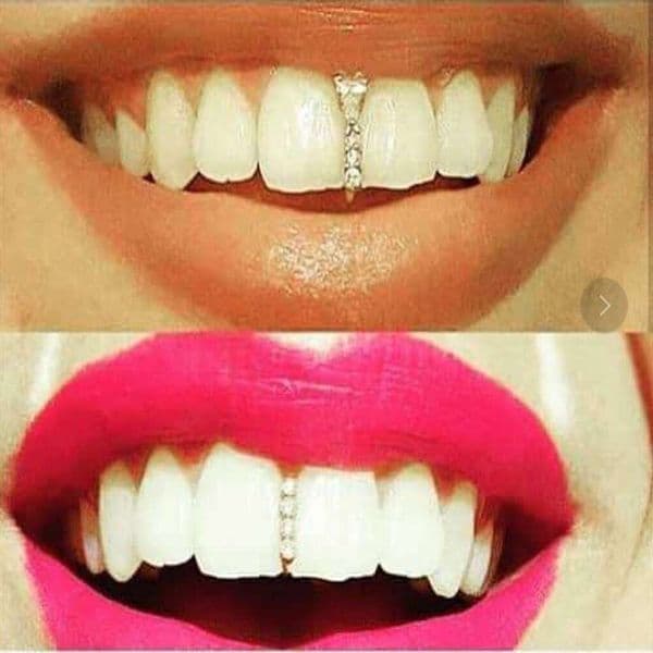 European and American creative Halloween diamond-encrusted gold bar hip-hop braces, single zirconia tooth braces