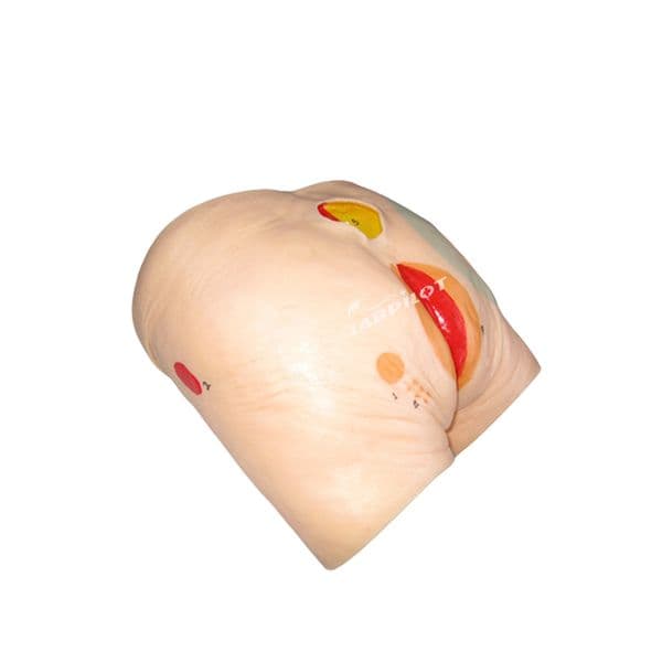 Decubitus Ulcer Care Model, Pressure Sore Nursing Practice Simulator Teaching Model