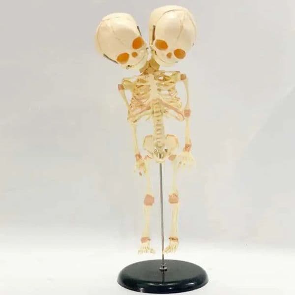 2026 37Cm Human Double Head Baby Skull Skeleton Anatomy Brain Display Study Teaching Anatomical Model Halloween Bar perfume Ornament cologne Free Shipping 17
