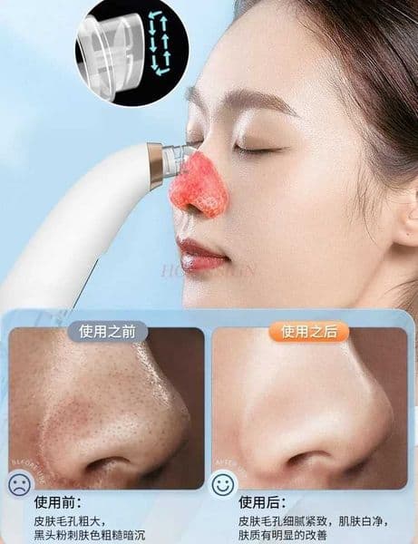 Visual blackhead absorber acne removal hole cleaner electric bubble blackhead absorber M240828
