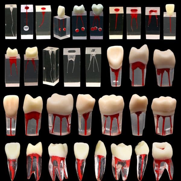 Dental Endo Root Canal Tooth Model RCT Training Block Practice Filling Endodontics Pulp Cavity Resin Teeth Dentistry Teach