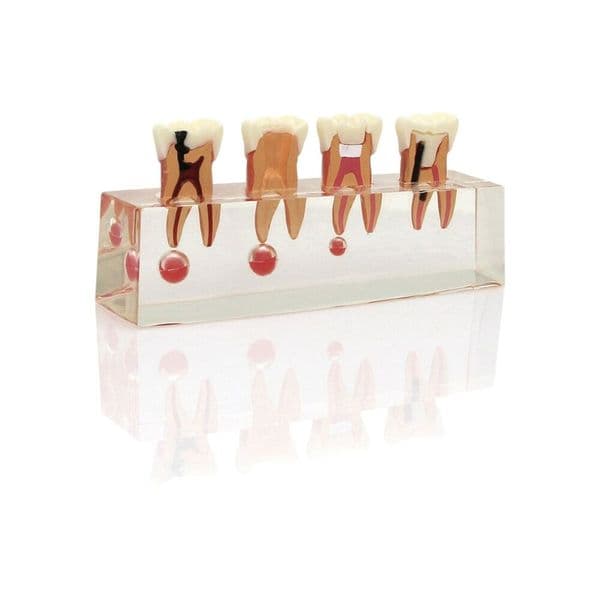 Dental Endodontic Treatment Teeth Model 4-Stages Clear Acrylic Base Teaching Studying Demo For Dentist M4018