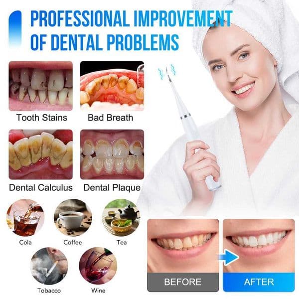 New Arrival Sonic Electric Dental Calculus Remover Tartar Plaque Pigment Cleaning Teeth Brush Whitening Kit Oral Hygiene Care G241017