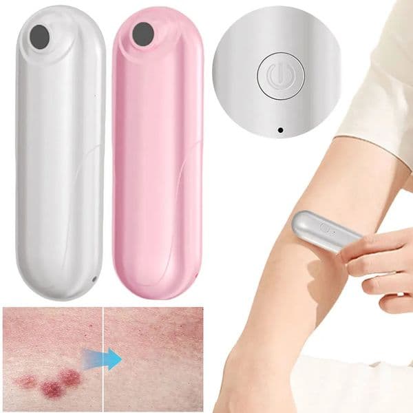 Portable Mosquito Insect Bite Relieve Itching Pen Chemical-Free Mosquito Bite Heat Pen Anti-Itch Pen for Camping Travel Outdoor 250721