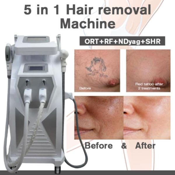 Portable Laser Tattoo Eyebrow Removal Yag Lasers With 4 Probes For Pigmentation Removal Machine377