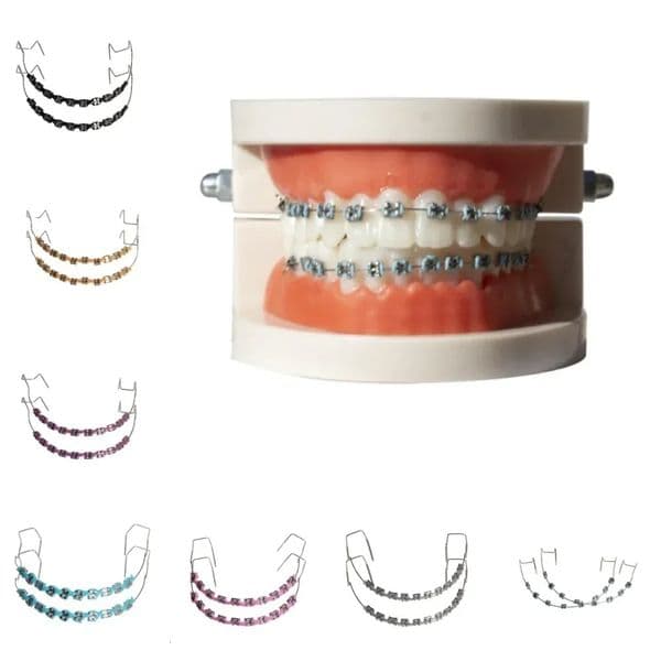 1 Pair of Oral Metal Bracket Model Colorful Fashion Oral Braces Decorative Orthodontic Bracket Denture Model 251113