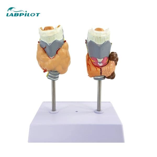 Pathological Thyroid Model, Hyperthyroidism and Hypothyroidism, Endocrine System, Medical Anatomy, Larynx Teaching Aid
