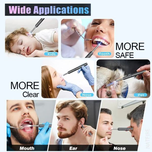 NATFIRE NP20 Smart Ear Cleaner Otoscope Ear Wax Removal Tool with Camera Ear Endoscope 1080P Kit for iPhone iPad Android